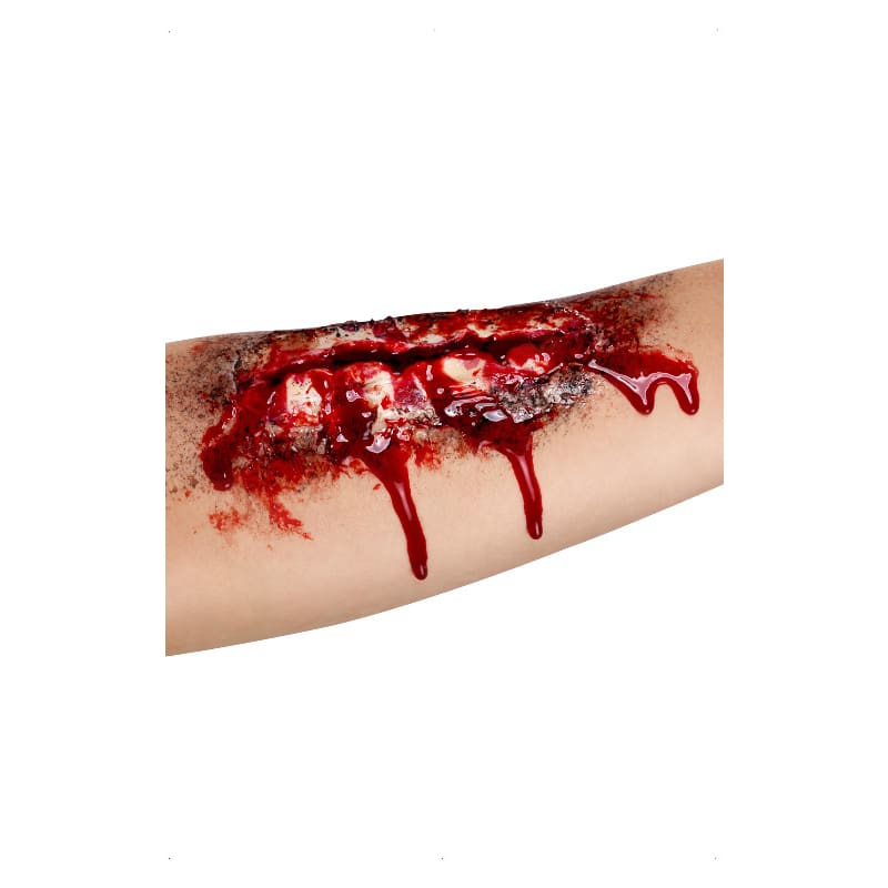 Scar Open Wound DNR